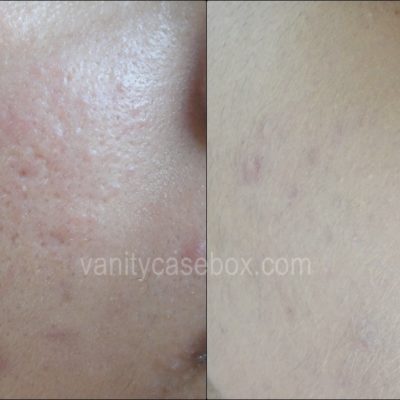 UPCOMING TUTORIAL – How To Minimize Pores Using Foundation